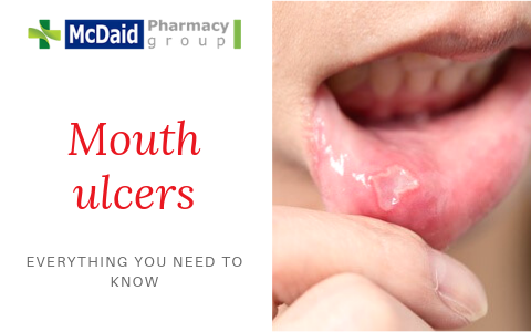 Mouth ulcers and Oral Thrush Everything you need to know