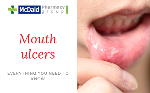 Mouth ulcers and Oral Thrush – Everything you need to know!